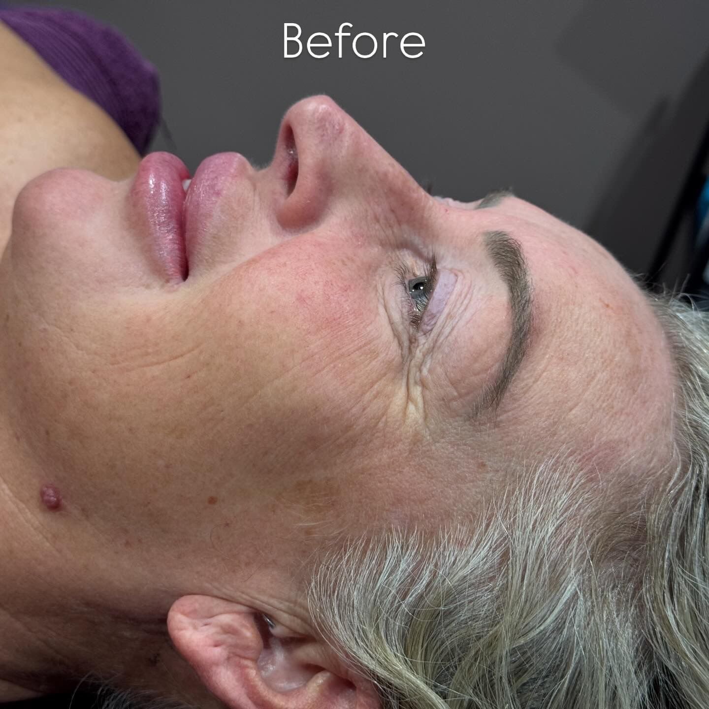 Before Image for The Deluxe Dermaplan